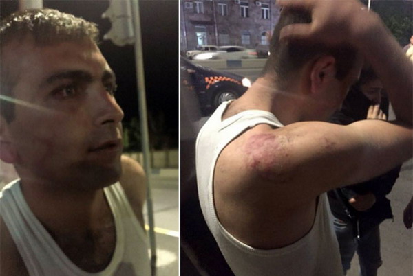 “With bruises on my face, with blood in my eyes, with ruptured lip.” Vaghinak Shushanyan about police beating