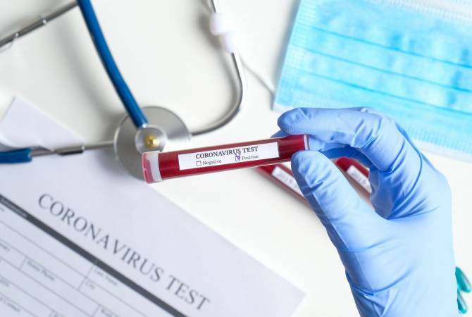 Coronavirus cases in Armenia reach 1,473
