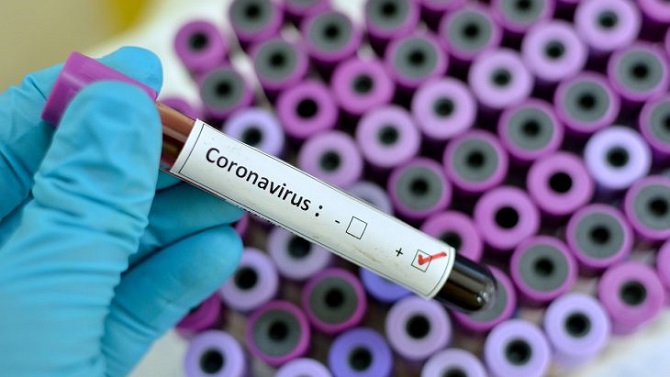 No new coronavirus cases in Armenia, nine patients test negative