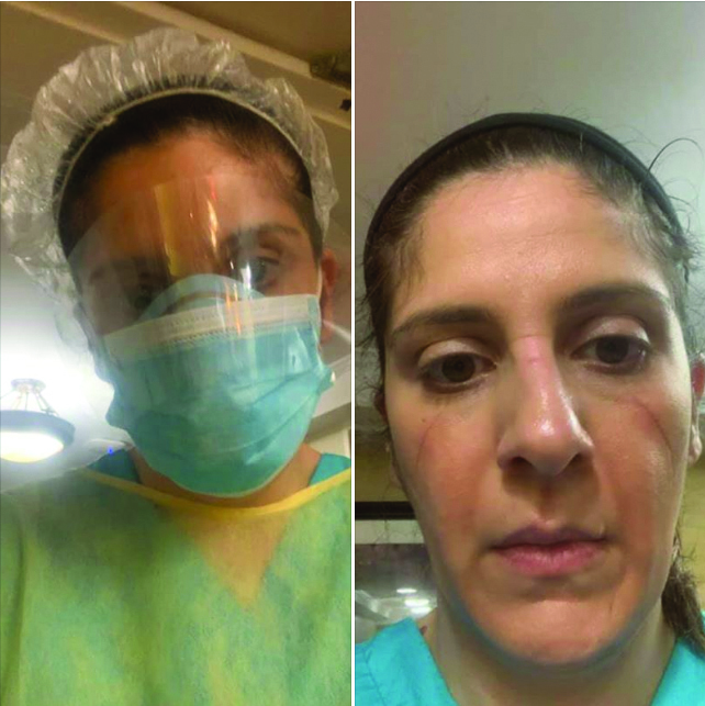 Karine Shnorhokian at the beginning and end of her long 15-hour shift on the front lines