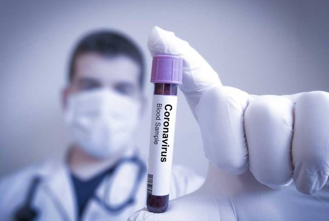 Armenia coronavirus cases surge past 5,000