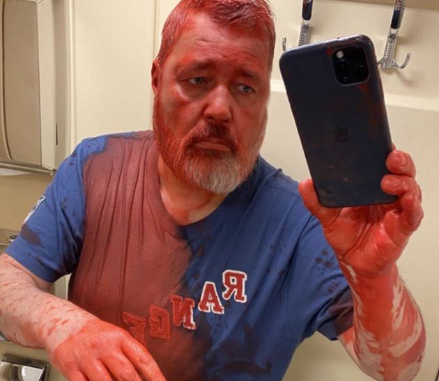 Russian journalist Dmitry Muratov attacked with paint
