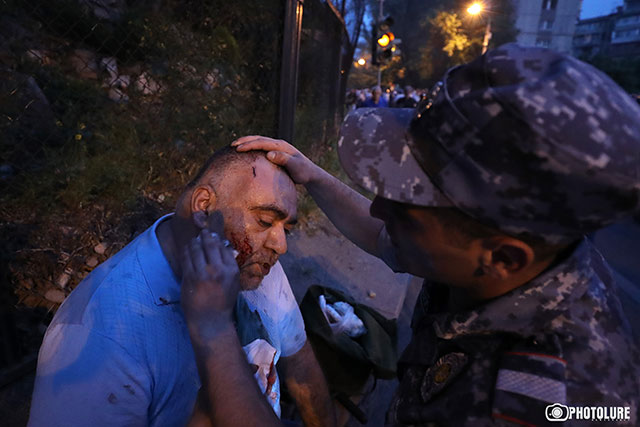 Dozens Injured In Police Clashes With Protesters In Armenia (Photos)